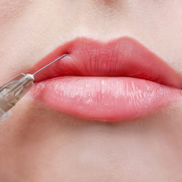 Herpes − So wirst Du ihn los